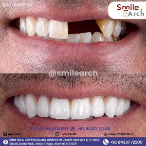 Smile Arch - Dental Care Clinic in Andheri West gallery