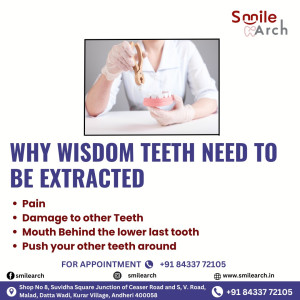 Smile Arch - Dental Care Clinic in Andheri West gallery