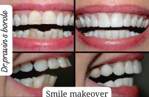 Anand Dental clinic & implant center gallery