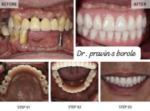 Anand Dental clinic & implant center service